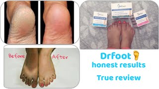 Drfoot spa range review|Say bye-bye to cracked heels ,bad odors,permanently|get smooth and soft feet screenshot 4