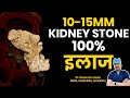 10 to 15mm Kidney Stone 100% इलाज | 10-15 mm Kidney Stones Treatment | Laser Kidney Stone Removal