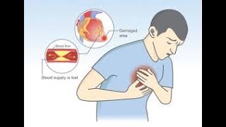 Lecture: Cardiac Arrest Part 2