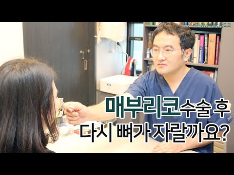 [부산서면성형외과] 매부리 코 수술후,  다시 뼈가 자랄까요?(*)
