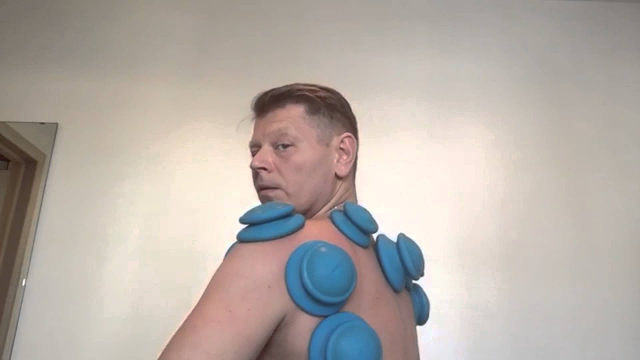 Вопросы и ответы. Лечение кашля банками. - YouTube