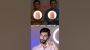 Why fingerprints are so unique #shorts #interestingfacts