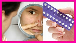 Do Birth Control Pills Cause ACNE?! + (How to get rid of ACNE in 1 week!)  | RealAsianBeauty