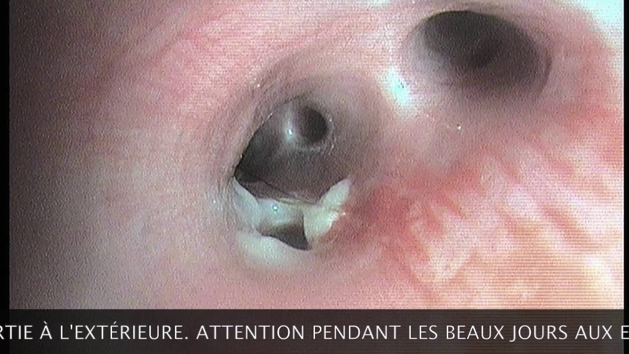 Epillet Chien Dangers Prevention Solutions Botaneo