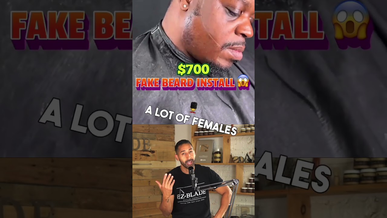 Beard Transplant Beard Wig Would You Do This??