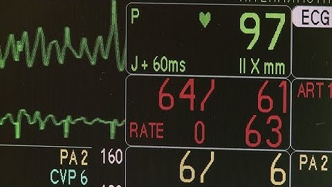 Can AI predict a heart attack?