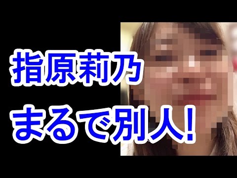 【衝撃】AKB48指原莉乃の顔が腫れて別人に！術後の写真が衝撃的すぎる！HKT48