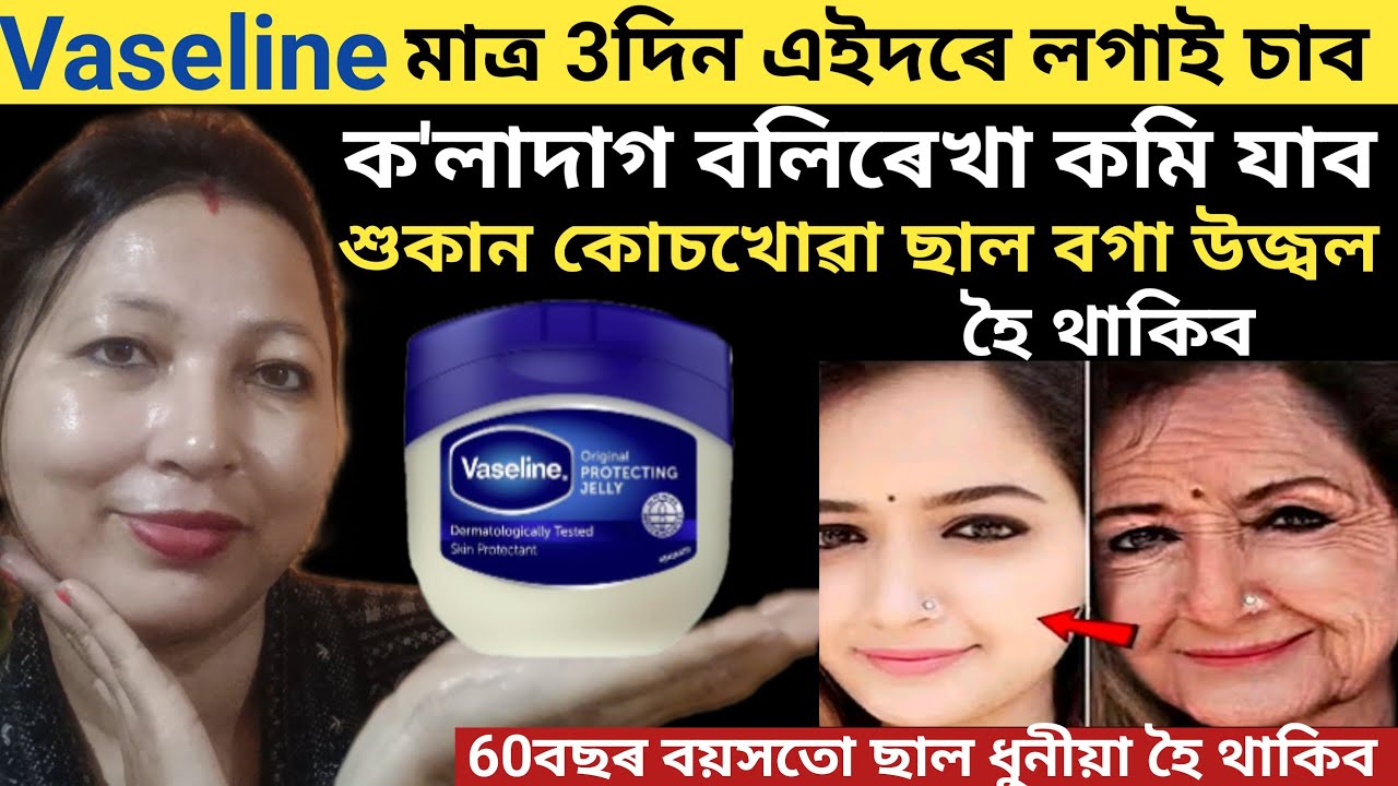 Vaseline মাত্ৰ 3দিন এইদৰে ব্যবহাৰ কৰি চাব শুকান কোচখোৱা ছাল ধুনীয়া বগা উজ্বল হৈ থাকিব | vlog 