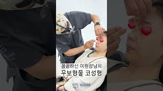 코성형 부목제거 전후 !  #강남역성형외과 #신논현성형외과 #성형외과