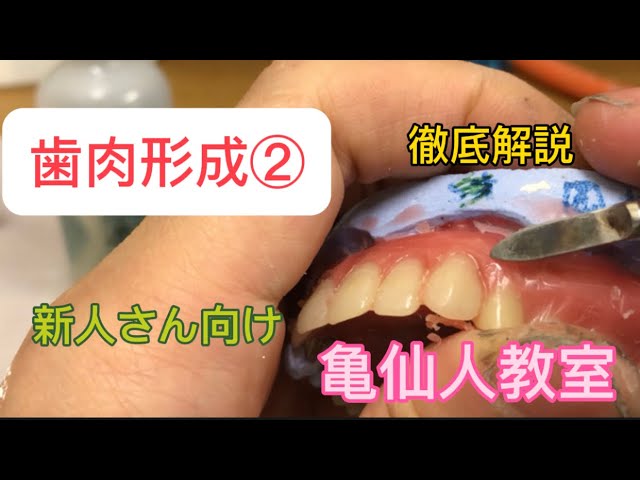 Master Roshi's Classroom: Gingival Contouring Part 2 – An In-Depth