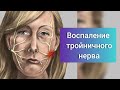 Воспаление тройничного нерва. По вопросам пишите на вотсап/тг 79109053539