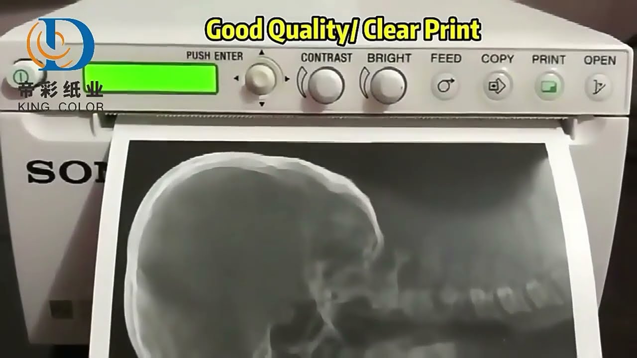 Eco-Friendly Ultrasound Paper: Is It Suitable for Medical Use?