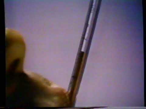 1979 Bufferin "The Fever Fighter" TV Commercial