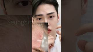 Thumbnail for 여드름을 없애주는 패치