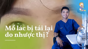 Nhược thị có mổ lác được không? | OptomDang