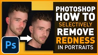 How to Selectively Reduce/Adjust Skin Redness in Photoshop