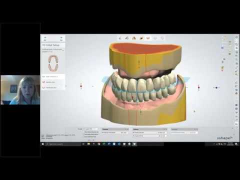 Webinar: Class 1 set up for digital dentures