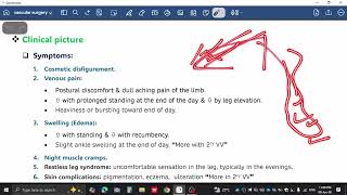 Vascular surgery By FLASH - venous system P2 (Varicose Vein + CVI)