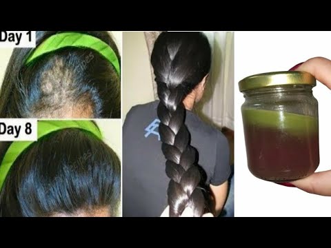 Indian secret🌿 to accelerate hair growth at a rocket speed and treat baldness