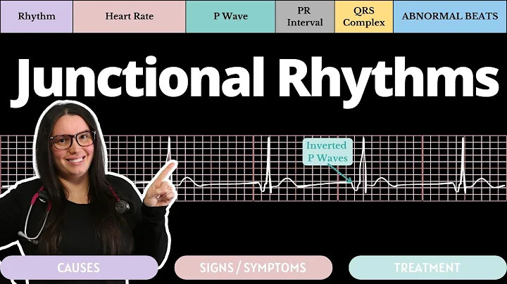 Junctional Rhythms on an EKG with Qs | Circulatory System and Disease | NCLEX-RN | Nurse Cheung