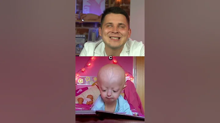 The rarest genetic mutation