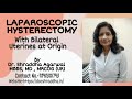 Total Laparoscopic Hysterectomy With Bilateral Uterines At Origin