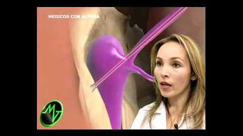 DACRIOESTENOSIS - Dra. Cecilia Montoya