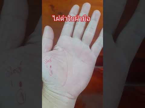 ไฝดำในฝ่ามือ #ลายมือ #ดูดวงแม่นๆ #ดูดวงลายมือ #ดูลายมือ #ความเชื่อ