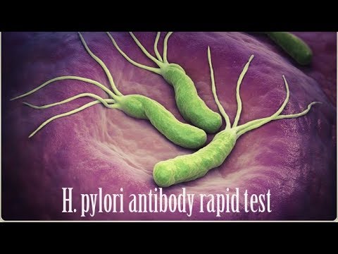 Today’s Trend In H pylori Testing and Treatment. 