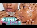 I Ate Aloe Vera & Used It On My Face For 5 Days! DID IT WORK?