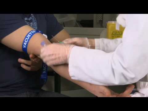 Video: Bilirubin Blodprøve: Prosedyre, Tilberedning Og Risiko