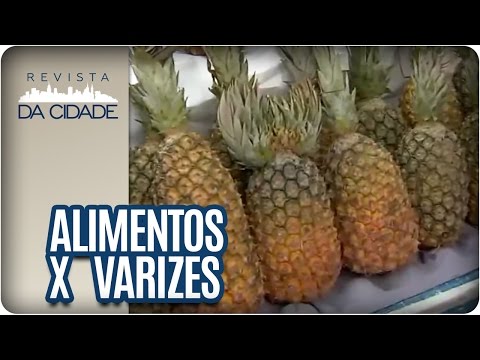 Vídeo: Dieta Para Varizes - Segredos Da Nutrição, O Que Você Pode Comer?