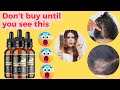 FoliPrime 😱 Warning 😱 FoliPrime Review | FoliPrime Hair Loss