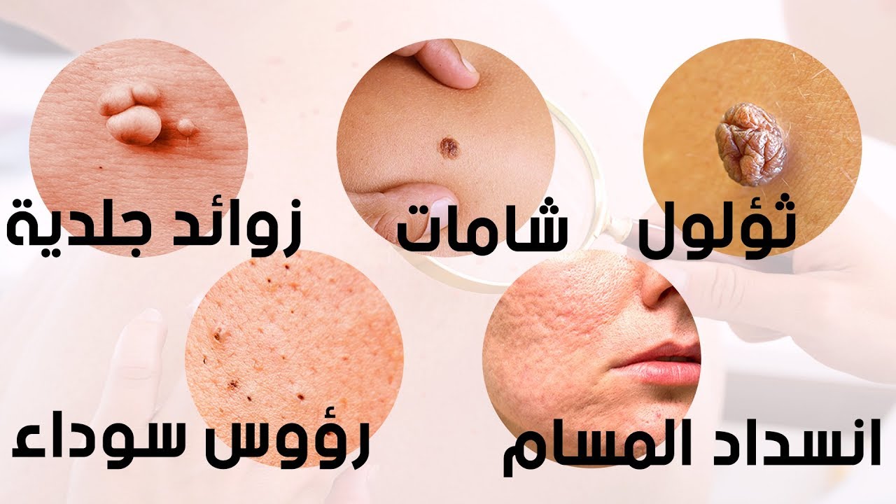 ثمانية أمراض خطيرة تدل عليها بشرتنا