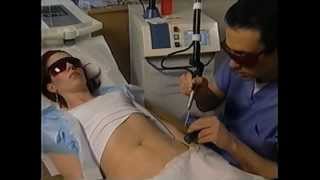 Stretch Mark Removal On Balance Stretch Mark Removal On Balance