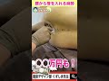 麻酔はどうやってやるの？？【硬膜外麻酔】 #Shorts