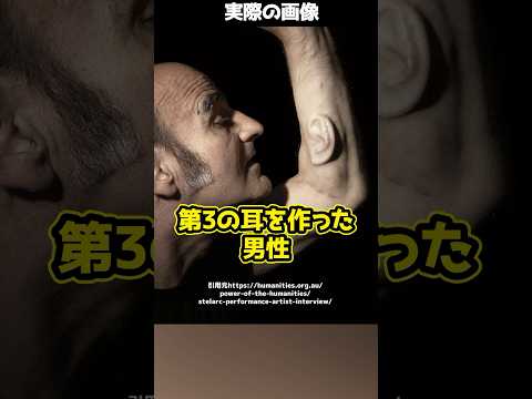 【人体実験】自分の腕に“第三の耳”をつけた男性とは!#shorts