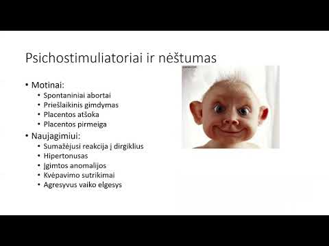 Video: Sujaudinimas - Požymiai, Gydymas, Priežastys, Formos, Diagnozė