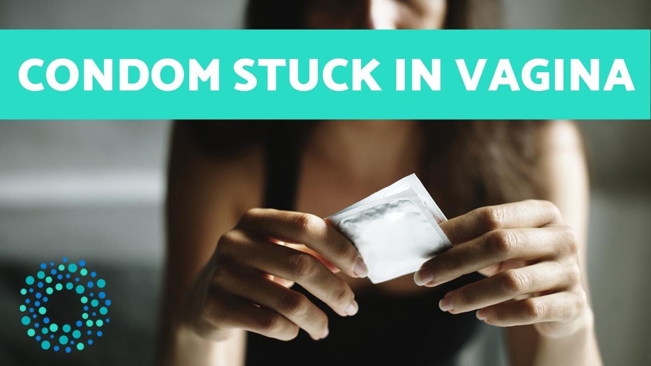 Condom STUCK in Vagina - What to do