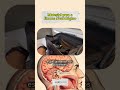 Material para o Exame Neurológico