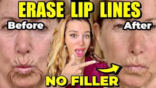 The Newest Way to Erase Smoker's Lines Without Filler