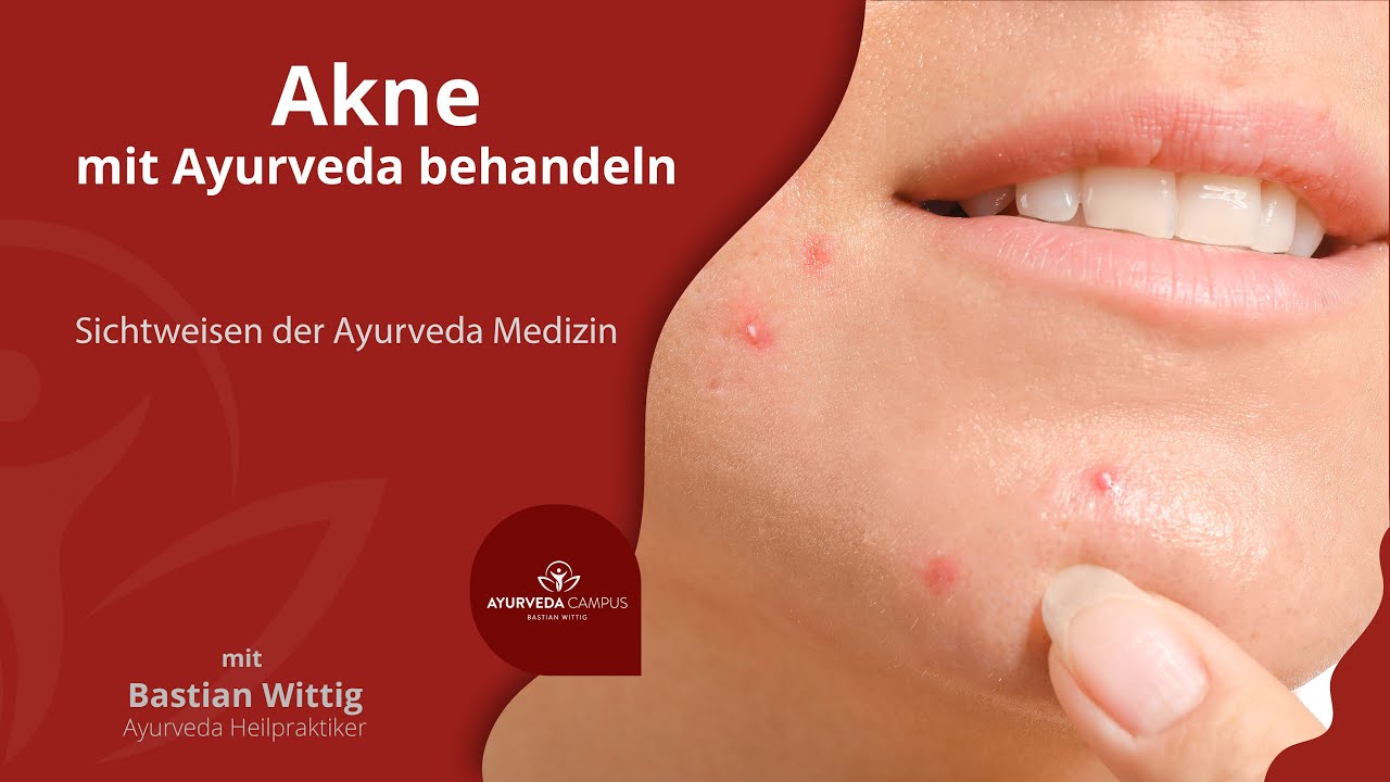 Akne mit Ayurveda behandeln Sichtweisen der Ayurveda Medizin YouTube
