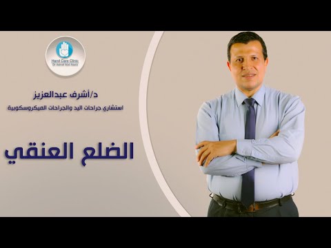 الضلع العنقي دكتور أشرف عبدالعزيز