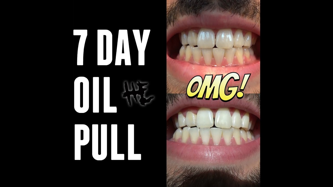 OIL PULLING EXPERIMENTS 1 Week Observations YouTube