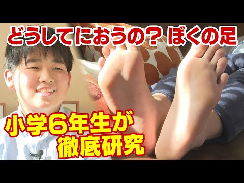 どうしてにおうの？ぼくの足」小学6年生が徹底研究 文献読み、医師に 