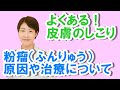 よくある皮膚のしこり粉瘤（ふんりゅう）の原因と治療【公式 やまぐち呼吸器内科・皮膚科クリニック】