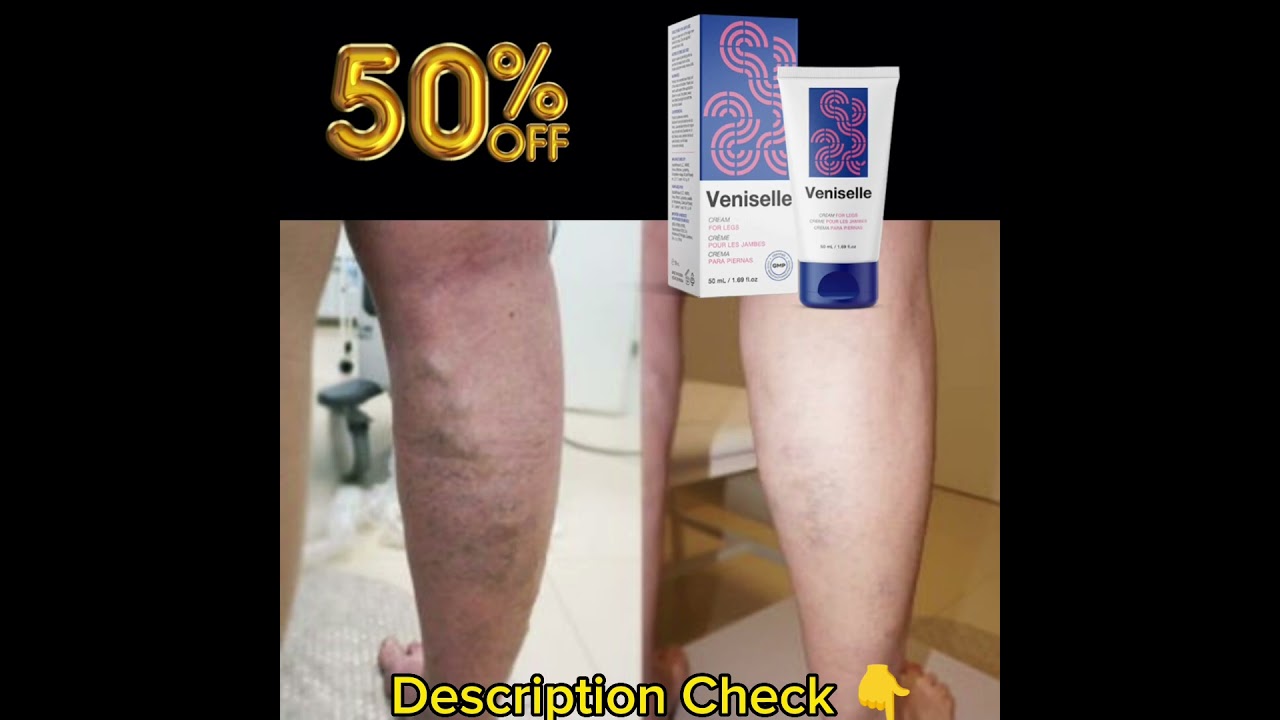 Veniselle, a new cream, claims it can help ease the pain of varicose veins. 