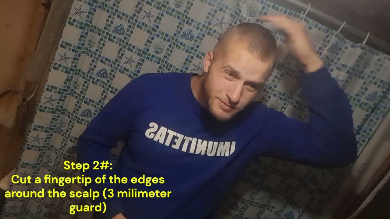 DIY Undercut – Bald Sides, Long Top