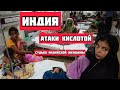 Индия: Шокирующая жизнь индийских женщин. Я в шоке! Кислотные атаки на русских девушек