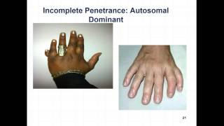 Module 7 Part 2 Narrated Lecture 11.5 11.6 and 11.7